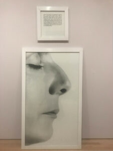 CALLE Sophie, The Plastic Surgery (Autobiographical Stories), 2000